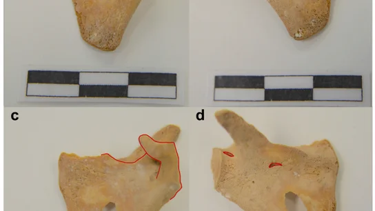 Parte de los restos hallados en la investigación realizada en Navarra Parte de los restos hallados en la investigación realizada en Navarra