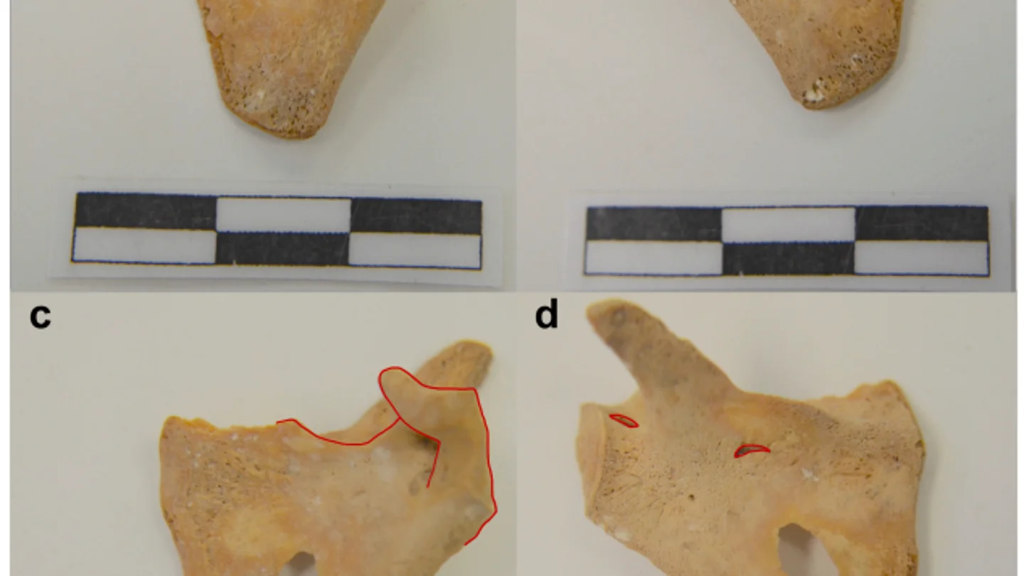 Parte de los restos hallados en la investigación realizada en Navarra Parte de los restos hallados en la investigación realizada en Navarra