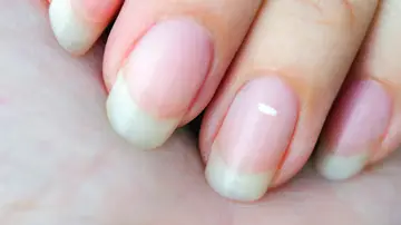 Mancha blanca uñas