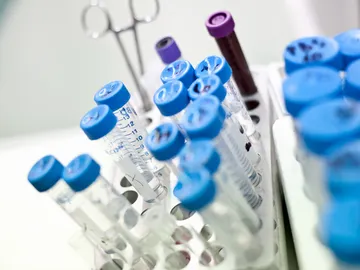 muestras de sangre muestras de sangre