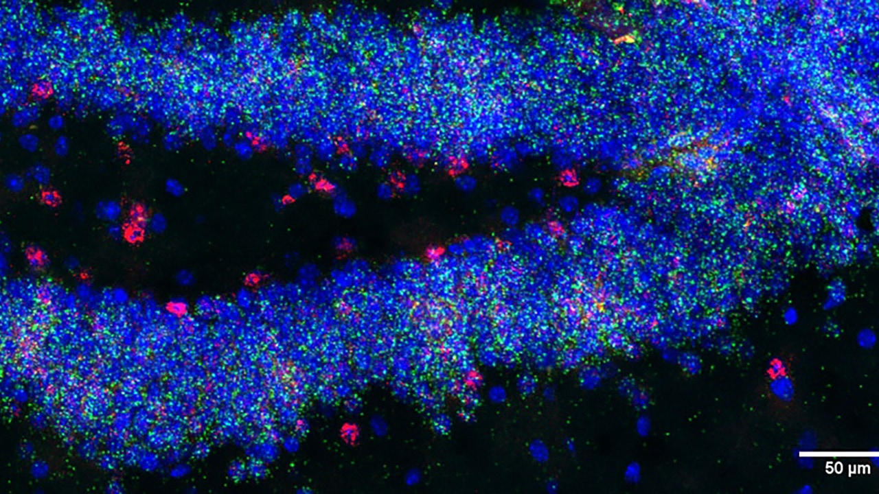 Problems with learning and memory in Down syndrome are associated with changes in the hidden part of the genome. Problems with learning and memory in Down syndrome are associated with changes in the hidden part of the genome.