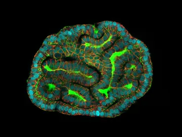 Organoides renales a partir de líquido amniótico Organoides renales a partir de líquido amniótico