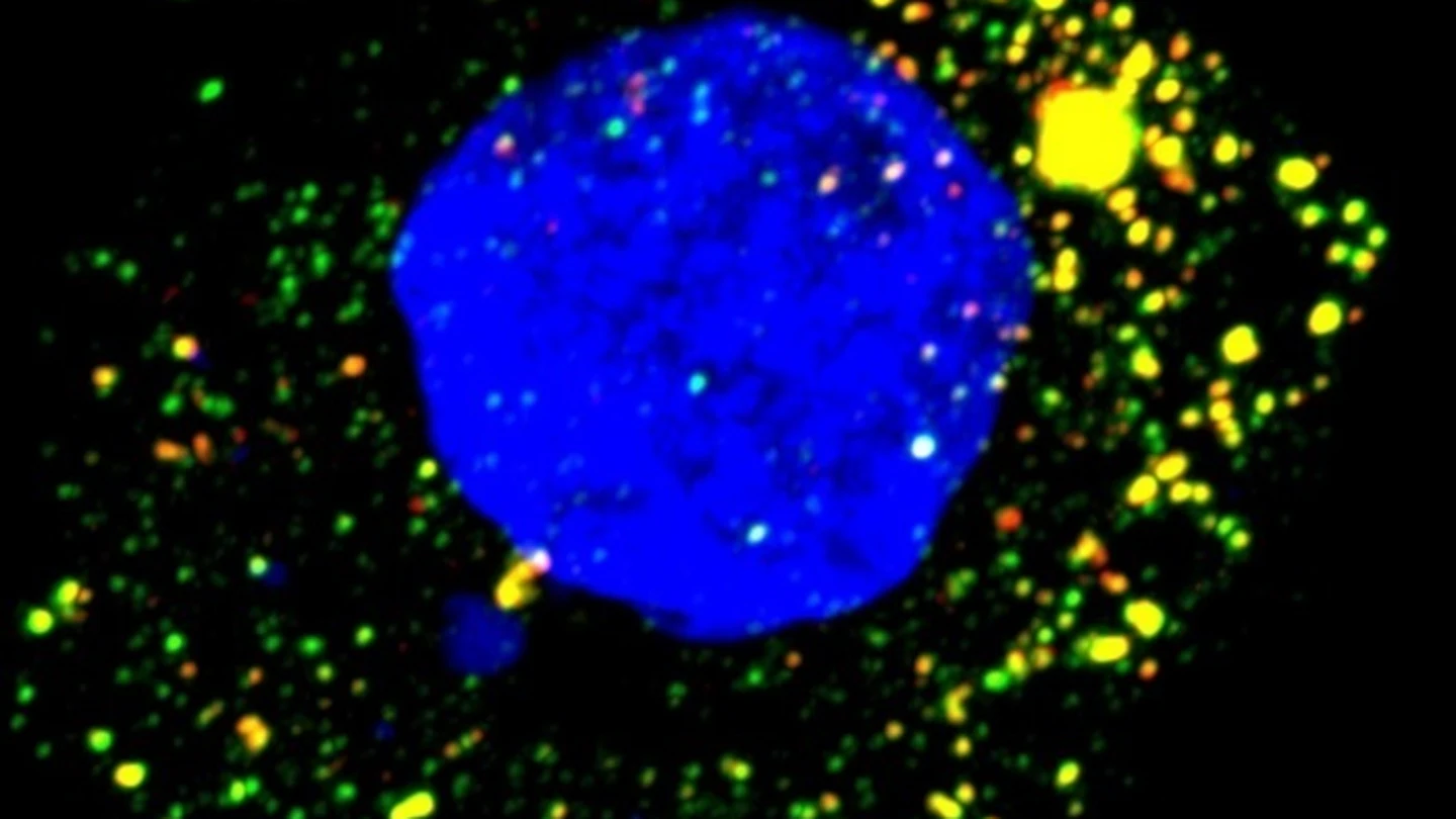 Imagen de microscopía de fluorescencia de células hepáticas humanas cultivadas infectadas con VHA. Imagen de microscopía de fluorescencia de células hepáticas humanas cultivadas infectadas con VHA.