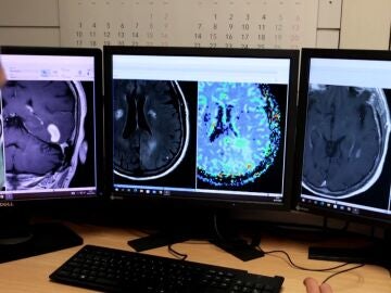 Imágenes de resonancia magnética de cerebro