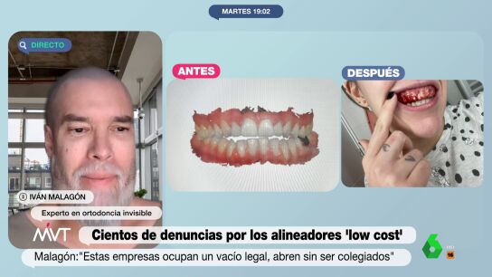 El experto Iv&aacute;n Malag&oacute;n advierte del peligro de los alineadores dentales 'low cost': "Se te pueden llegar a caer los dientes"