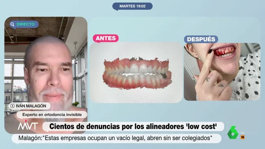 El experto Iván Malagón advierte del peligro de los alineadores dentales 'low cost': "Se te pueden llegar a caer los dientes" El experto Iván Malagón advierte del peligro de los alineadores dentales 'low cost': "Se te pueden llegar a caer los dientes"