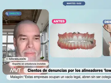 El experto Iván Malagón advierte del peligro de los alineadores dentales &#39;low cost&#39;: &quot;Se te pueden llegar a caer los dientes&quot;