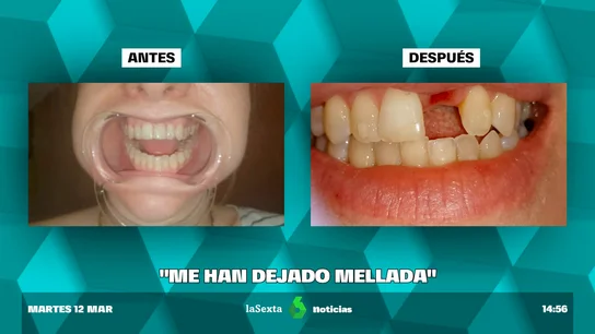 alineadores alineadores