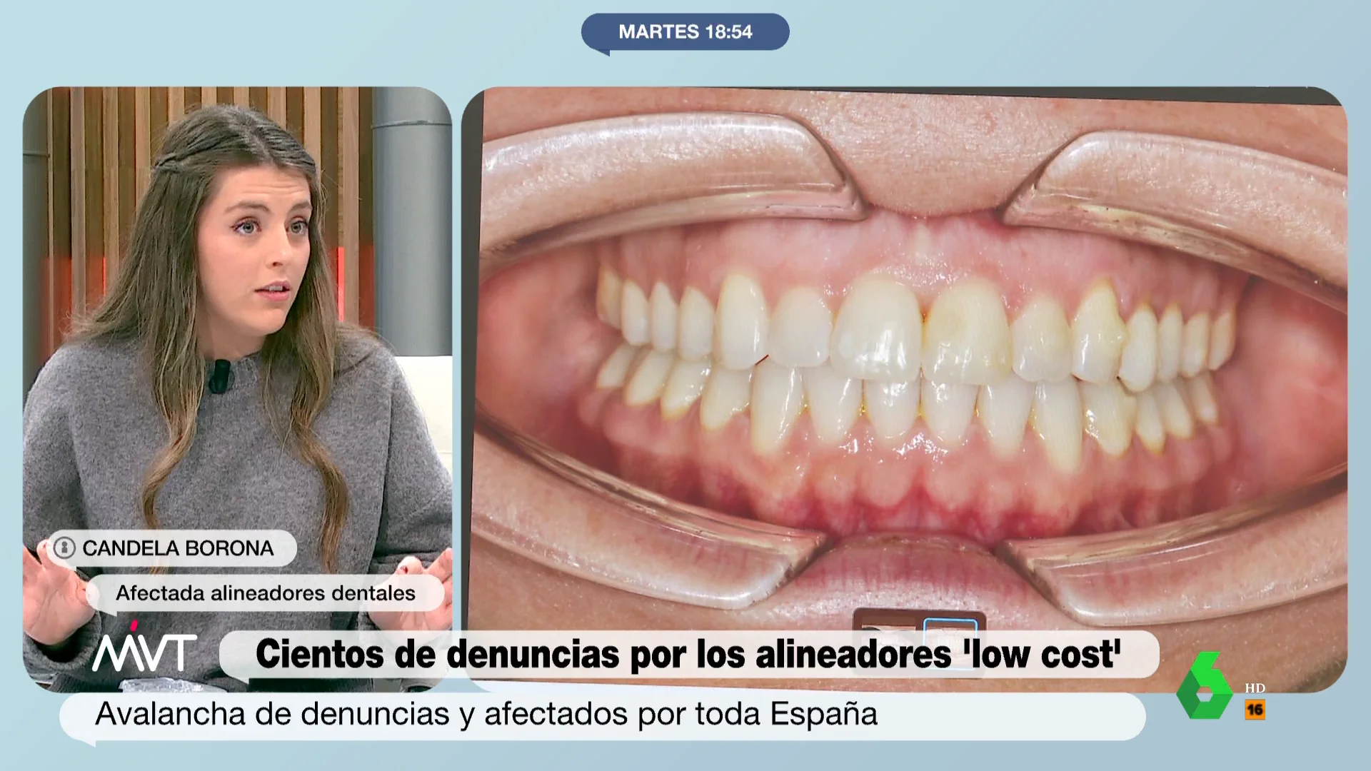 dientes