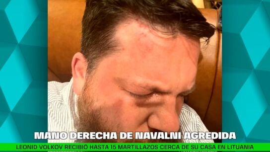 Agresi&oacute;n contra Leonid Volkov, la mano derecha de Navalni