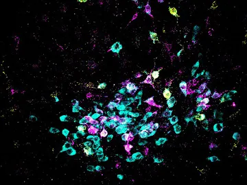 neuronas neuronas