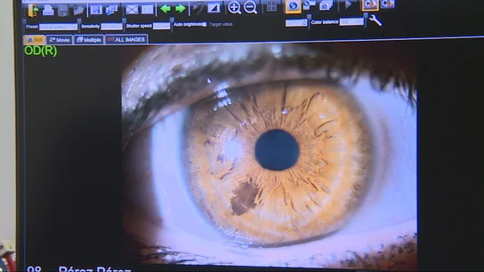 Revisión de un ojo Revisión de un ojo