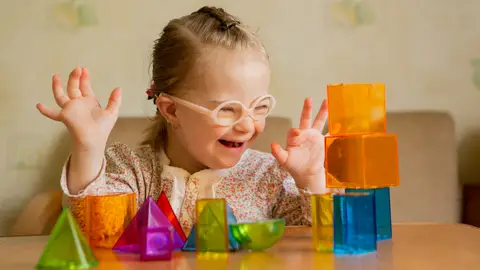 Niña con síndrome de Down Niña con síndrome de Down