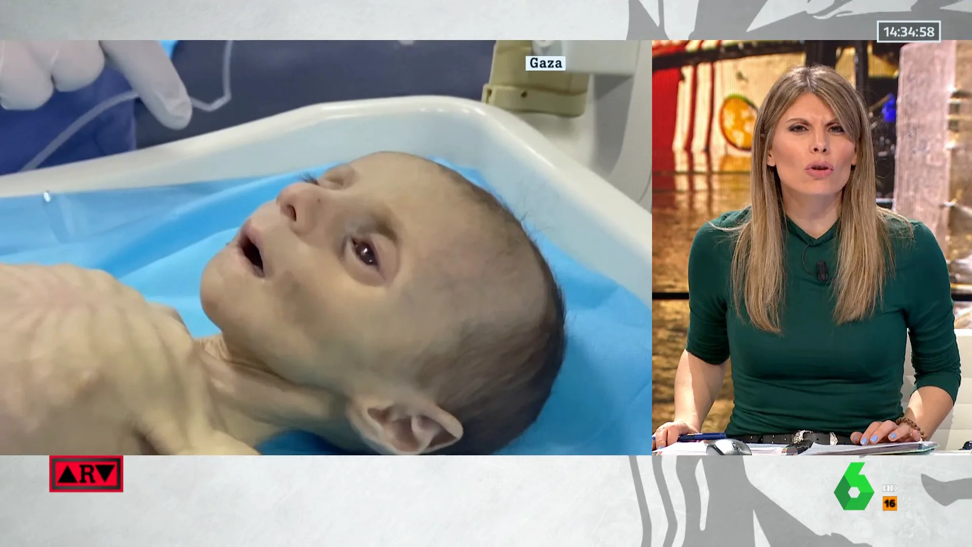La pequeña Leila, el rostro de la hambruna en Gaza La pequeña Leila, el rostro de la hambruna en Gaza