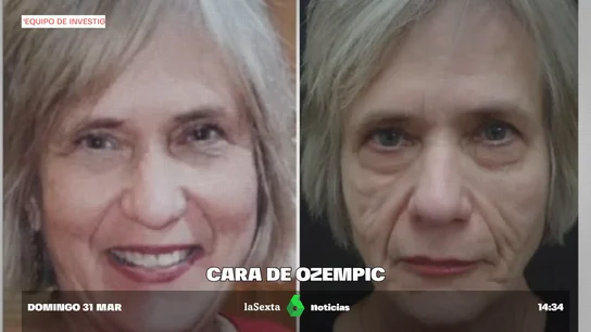 OZEMPIC OZEMPIC