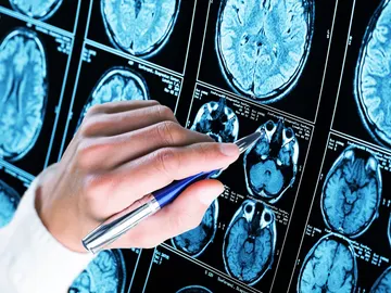 Distintas zonas de un cerebro Distintas zonas de un cerebro
