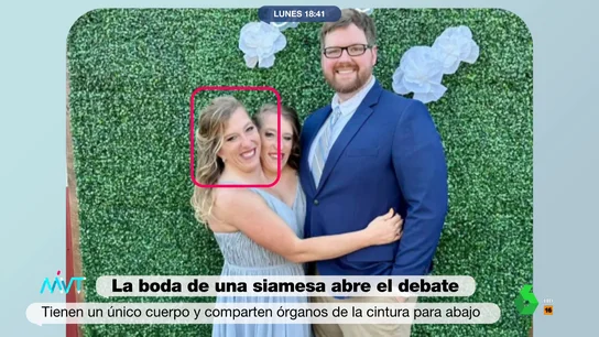 MVT Siamesas MVT Siamesas