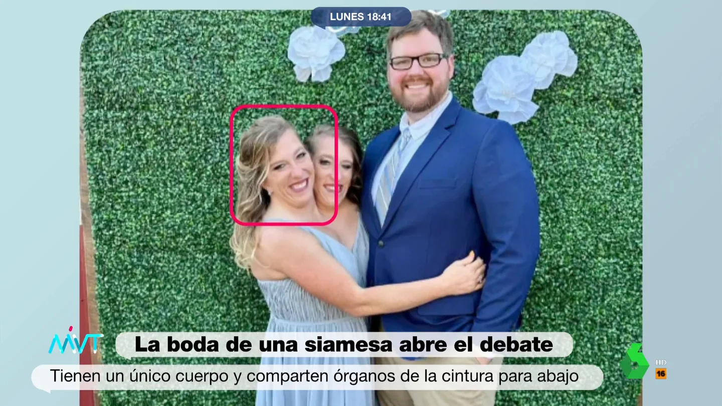 MVT Siamesas MVT Siamesas