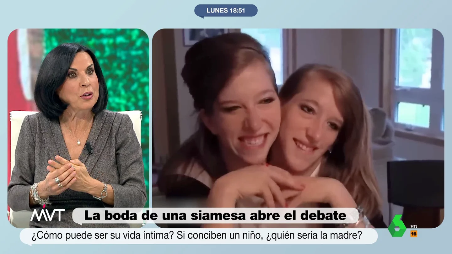 MVT DebateSiamesas MVT DebateSiamesas