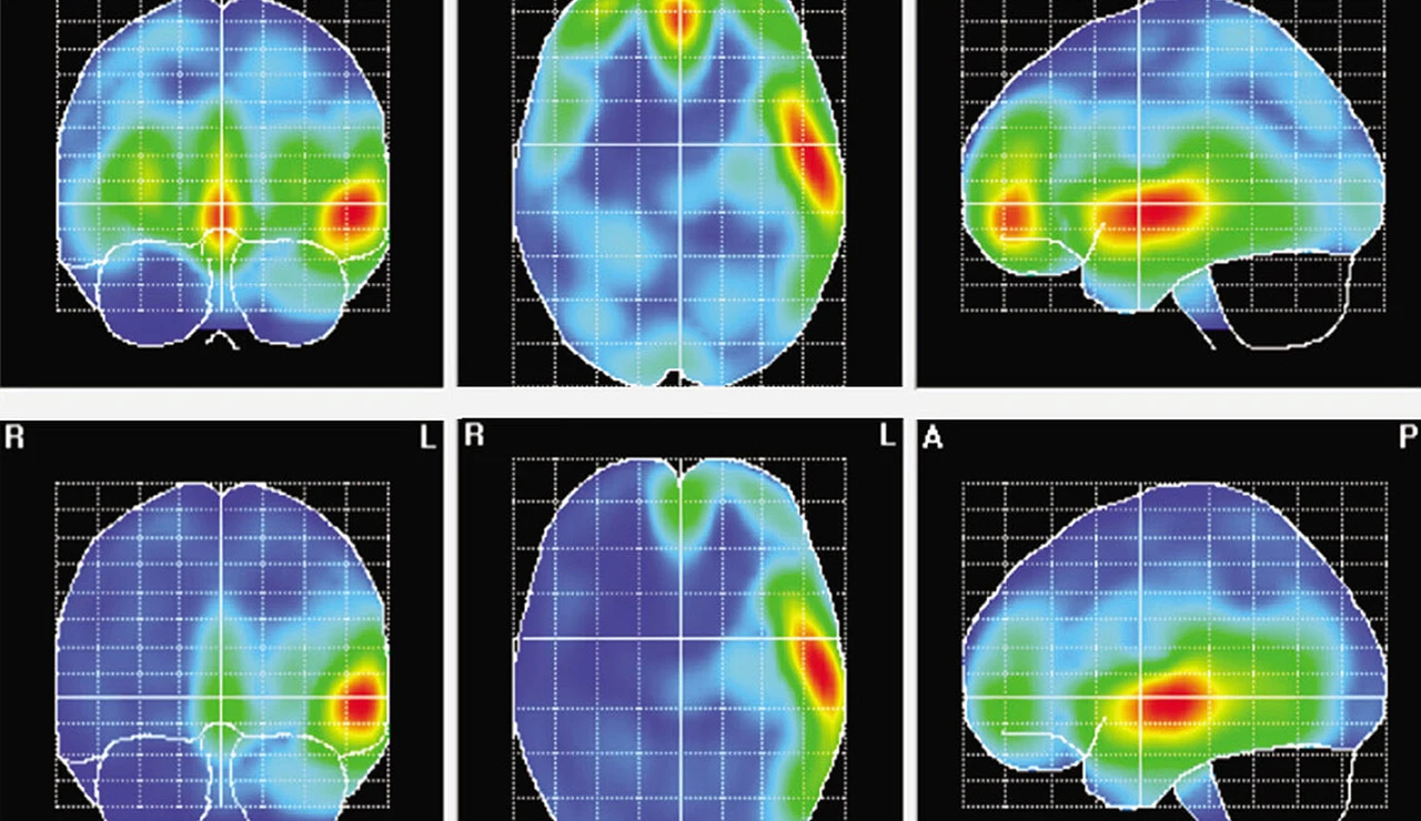 Actividad cerebral en mujeres (arriba) y hombres (abajo) durante el experimento
