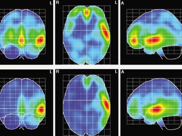Actividad cerebral en mujeres (arriba) y hombres (abajo) durante el experimento