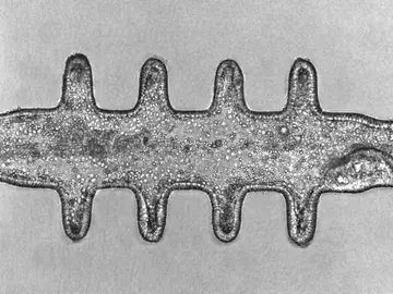 organoides de colon organoides de colon