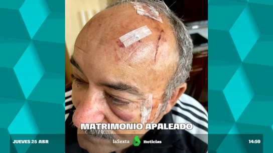 Habla el matrimonio que sufrió un robo con violencia: "Creíamos que nos mataban" Habla el matrimonio que sufrió un robo con violencia: "Creíamos que nos mataban"