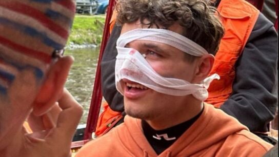 Lando Norris tras recibir un golpe en la cara en Pa&iacute;ses Bajos