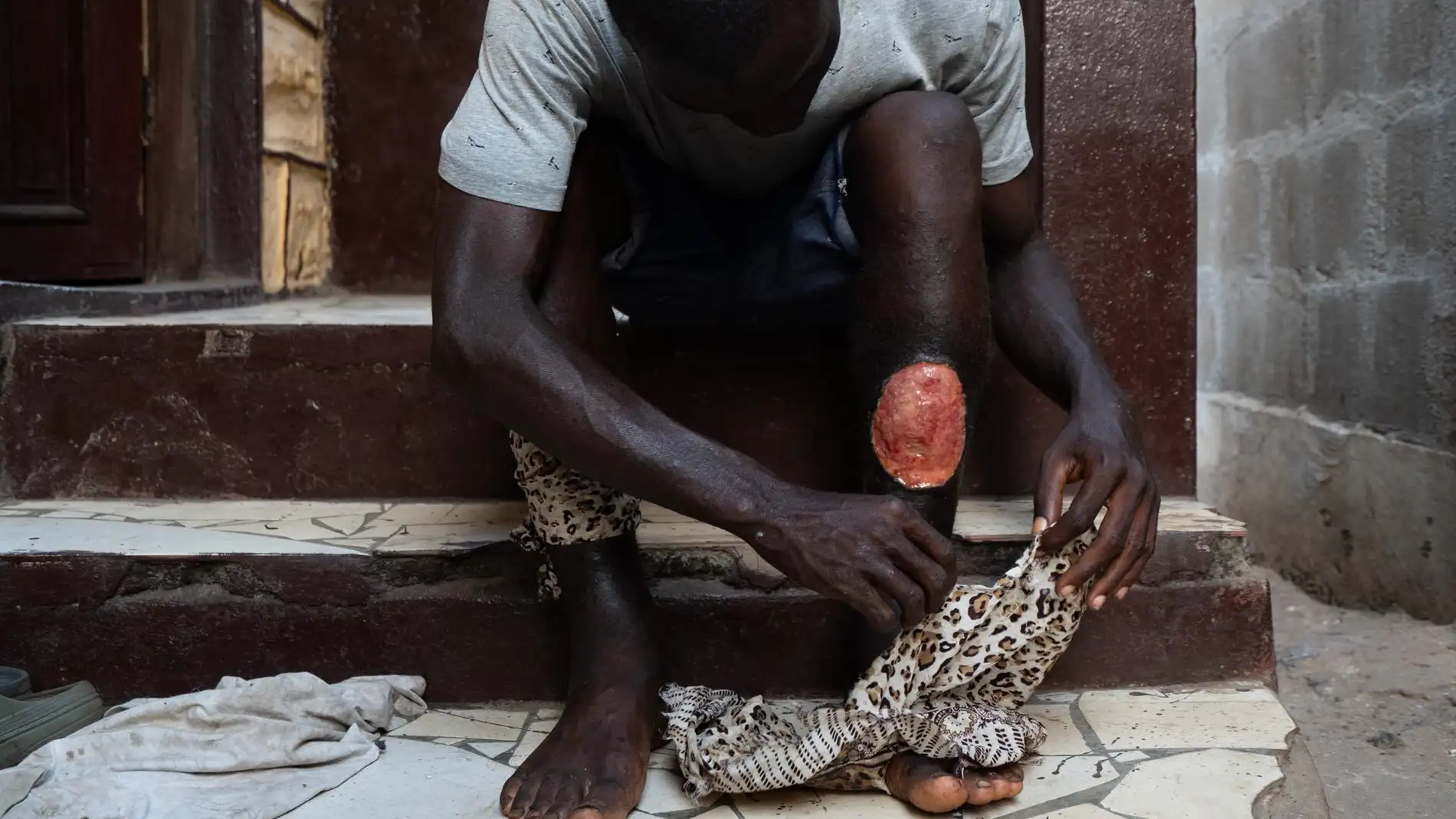 Afectado por la droga kush Afectado por la droga kush