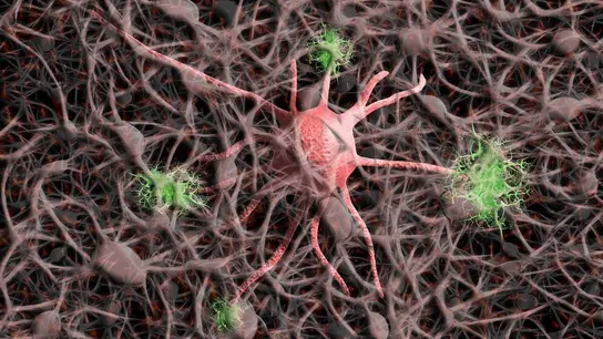 El alzheimer familiar puede transferirse mediante trasplante de medula osea en ratones El alzheimer familiar puede transferirse mediante trasplante de medula osea en ratones