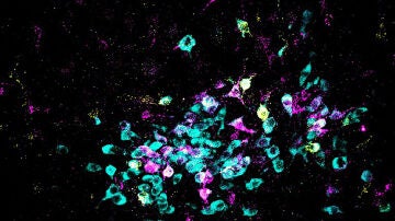 neuronas