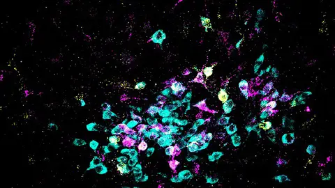 neuronas neuronas