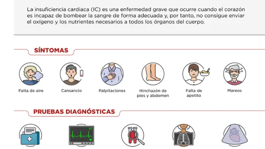 Infografía de la insuficiencia cardiaca Síntomas de la insuficiencia cardiaca