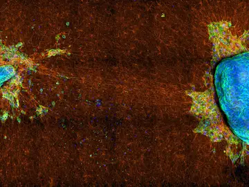 Explantes de tumor Explantes de tumor