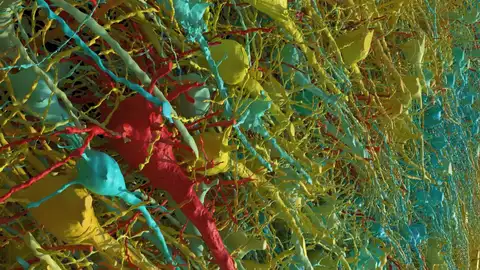 Neuronas excitadoras de una parte de la muestra de cerebro Neuronas excitadoras de una parte de la muestra de cerebro