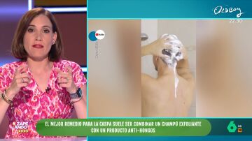 ¿Ayuda el vinagre a eliminar la caspa? Boticaria García descarta que sea el mejor remedio para tratarla