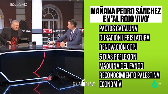 SANCHEZ ARV SANCHEZ ARV