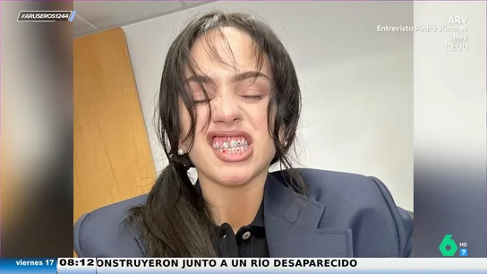 Tatiana Arús alucina con los dientes de colores de Rosalía: "El brillante está torcido, no sé si al comer carne se le ha movido" Tatiana Arús alucina con los dientes de colores de Rosalía: "El brillante está torcido, no sé si al comer carne se le ha movido"