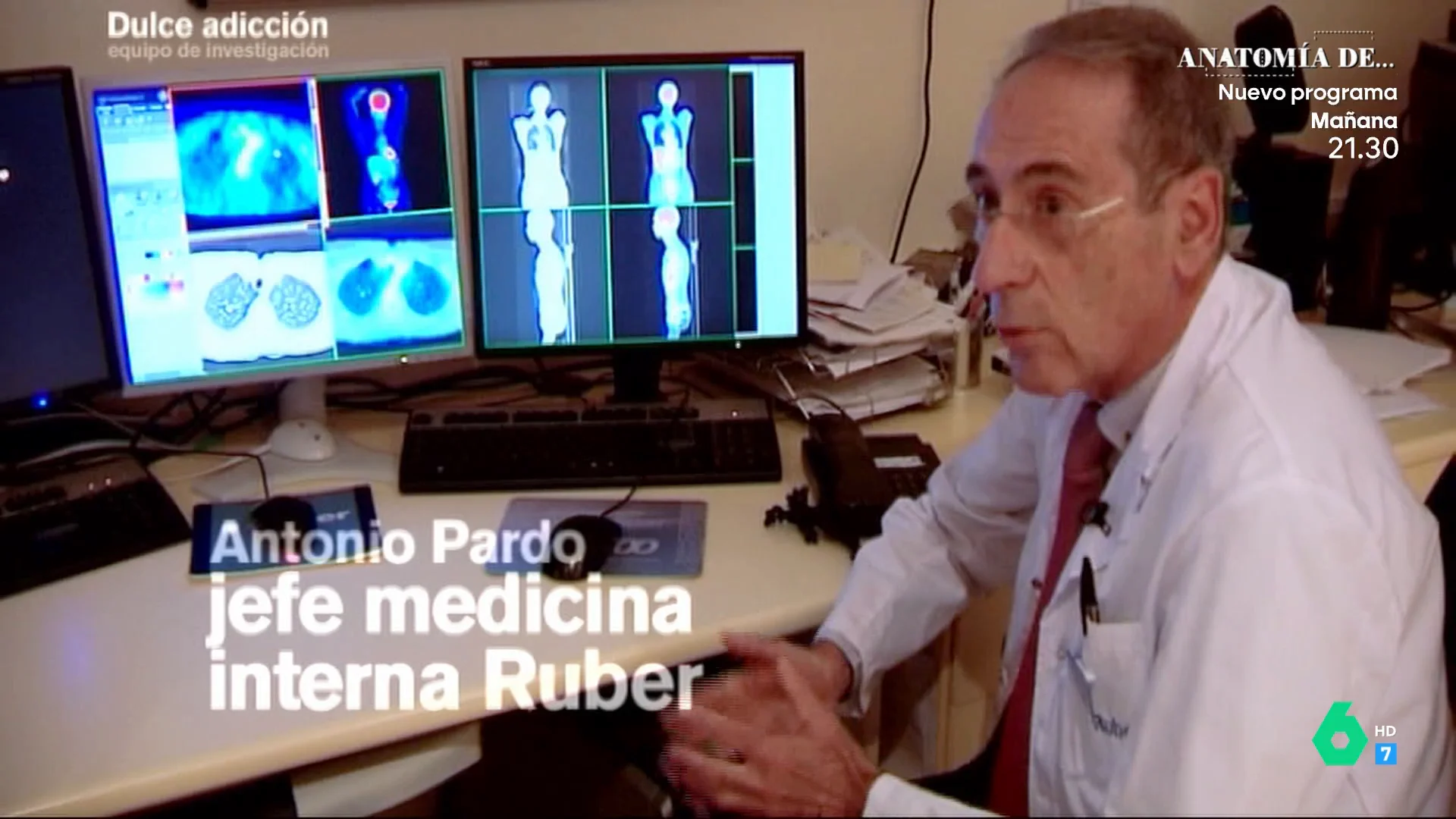 Un médico describe la glucosa como "la gasolina intracelular": "Es imprescindible para la vida"