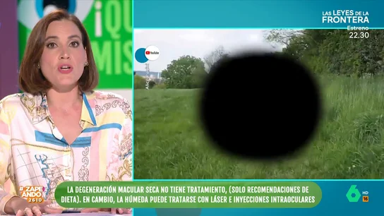 ¿Qué es la degeneración macular? Boticaria García explica que afecta a la parte media de la visión ¿Qué es la degeneración macular? Boticaria García explica que afecta a la parte media de la visión