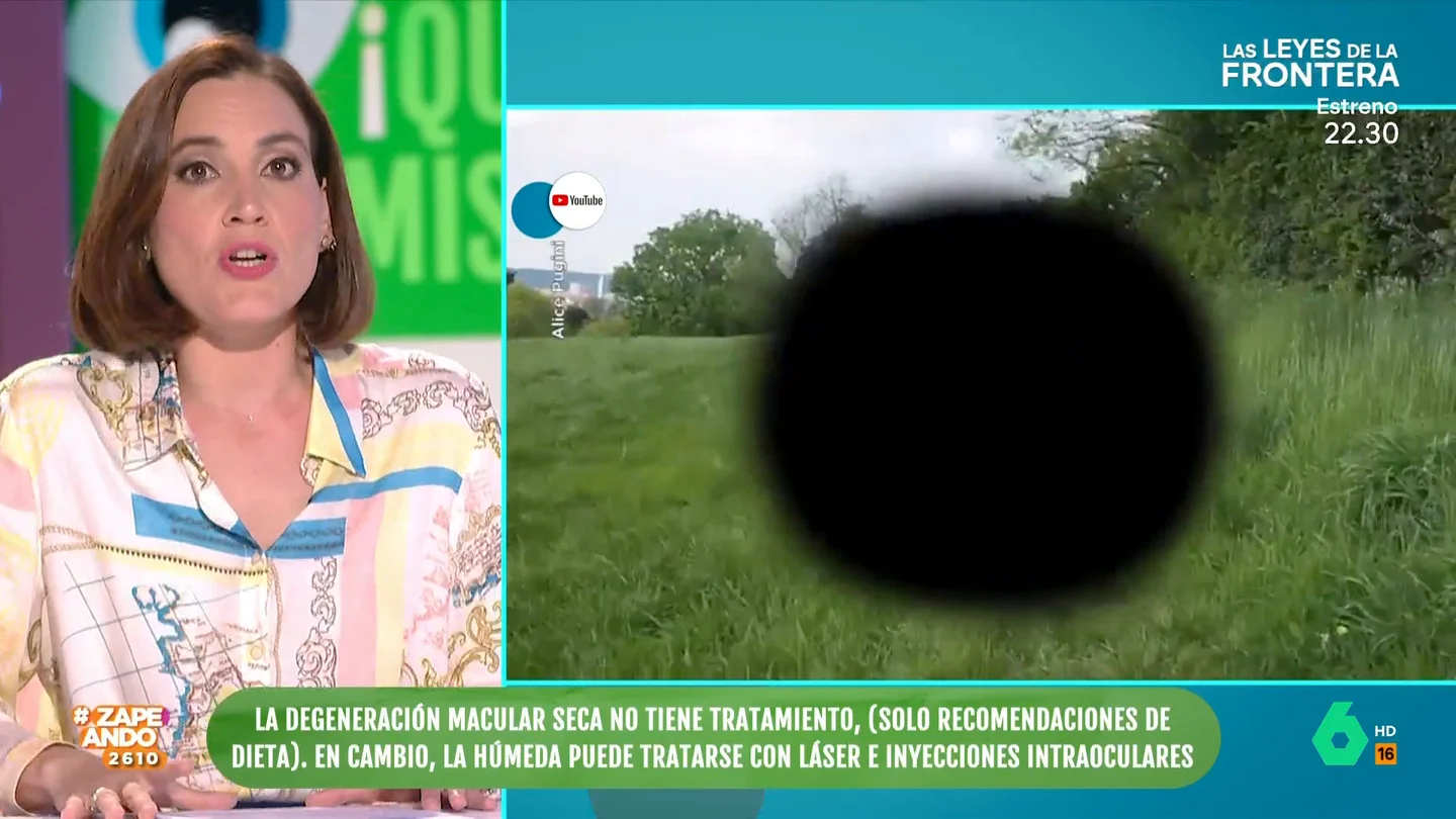 ¿Qué es la degeneración macular? Boticaria García explica que afecta a la parte media de la visión ¿Qué es la degeneración macular? Boticaria García explica que afecta a la parte media de la visión