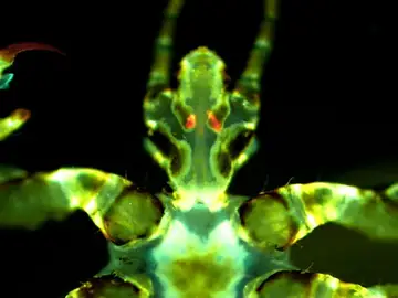 Piojo del cuerpo humano con infección por Yersinia pestis Piojo del cuerpo humano con infección por Yersinia pestis