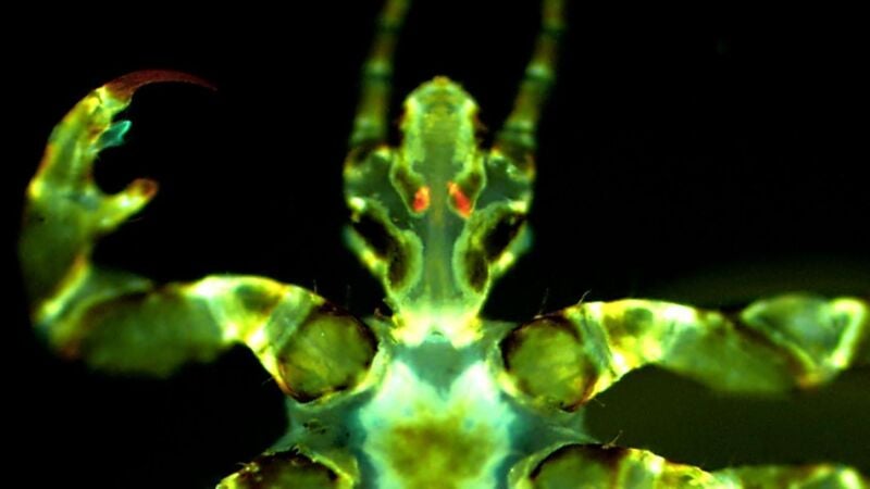 Descubren que los piojos pueden transmitir una bacteria causante de la peste