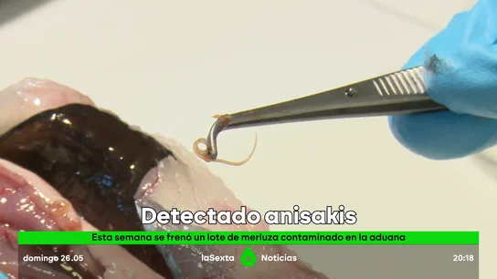 SET ANISAKIS SET ANISAKIS