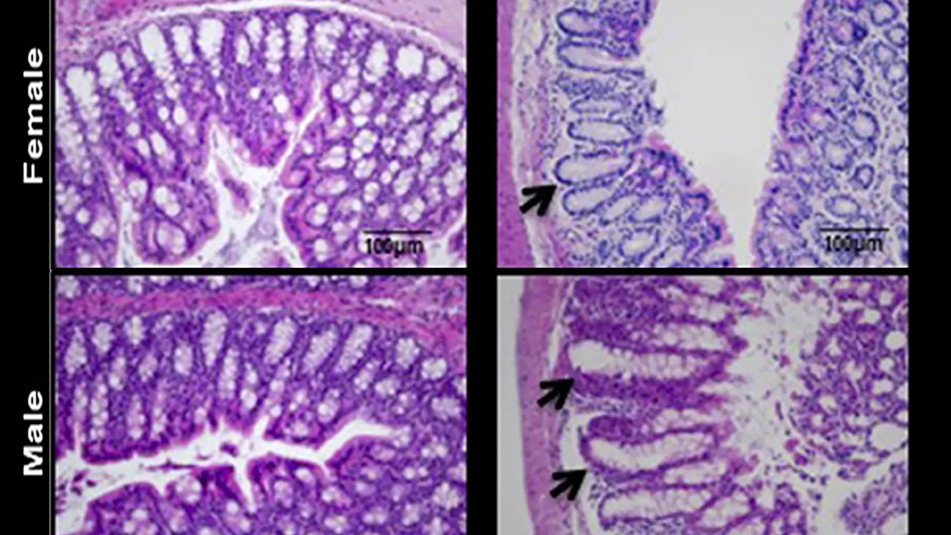 La barrera intestinal en el intestino grueso de ratones hembra se mantiene parcialmente en comparación con los machos La barrera intestinal en el intestino grueso de ratones hembra se mantiene parcialmente en comparación con los machos