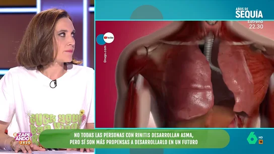 ¿Todas las personas con rinitis van a desarrollar asma? Boticaria Garcia lo aclara en Zapeando ¿Todas las personas con rinitis van a desarrollar asma? Boticaria Garcia lo aclara en Zapeando