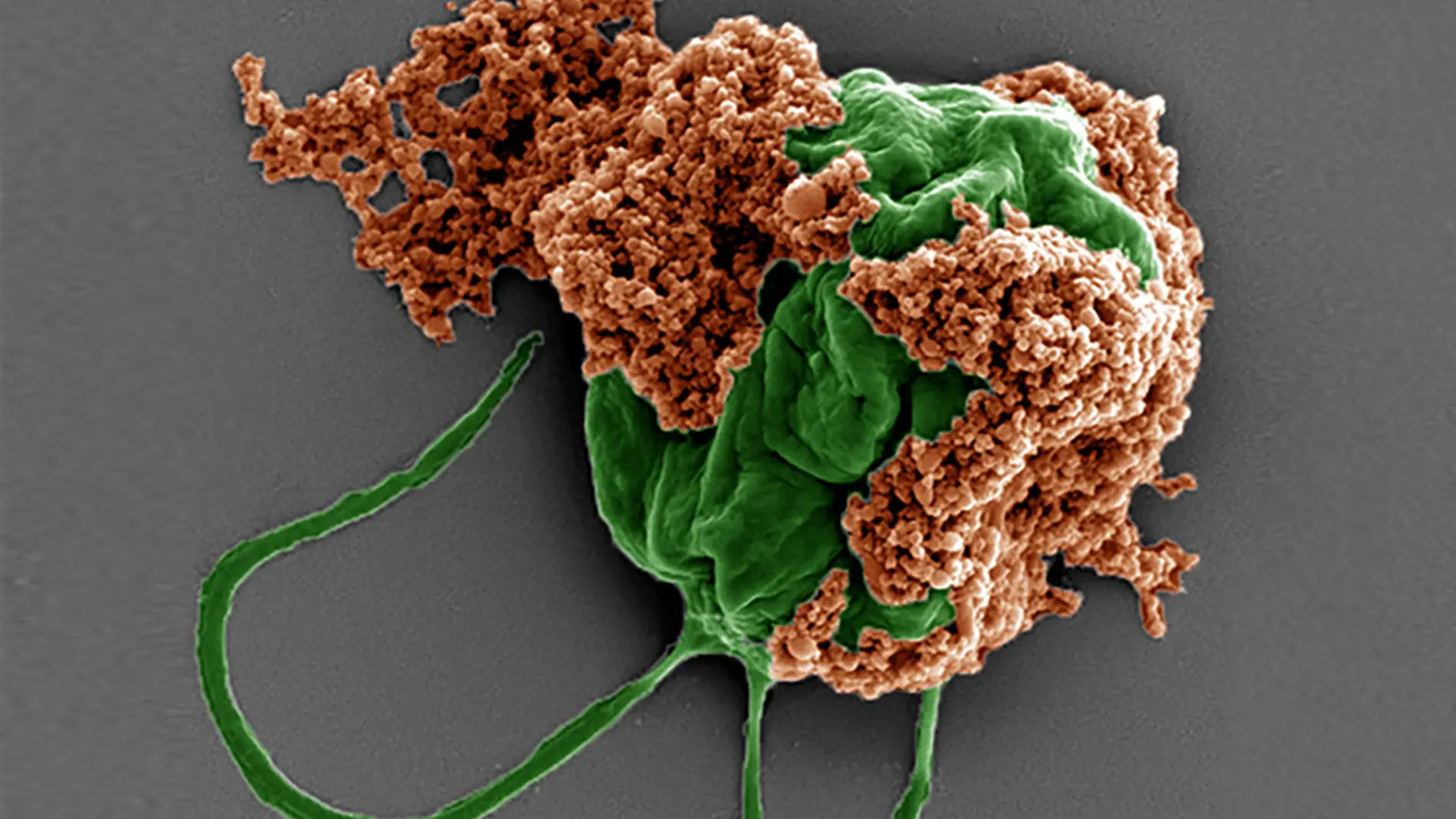 microrobots contra la metástasis en pulmones microrobots contra la metástasis en pulmones