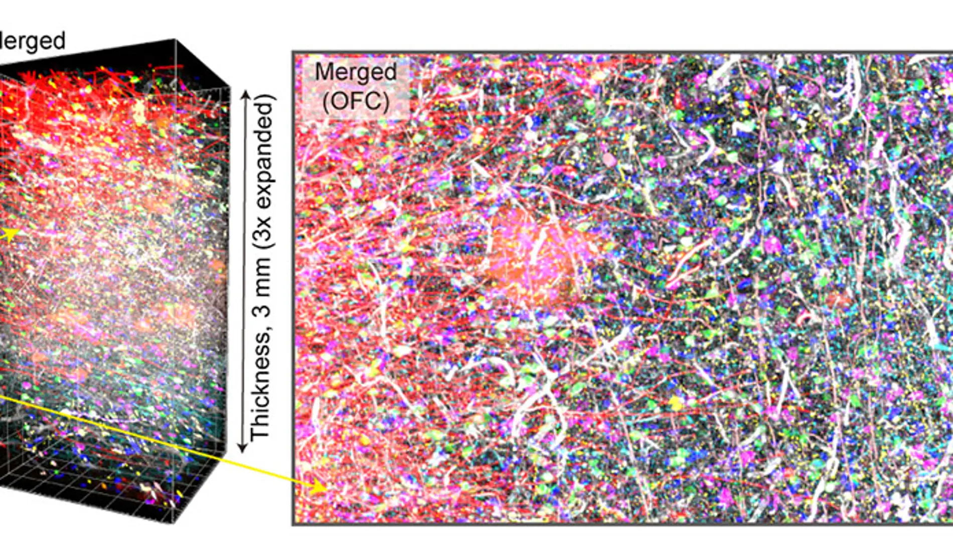 imagen cerebro imagen cerebro