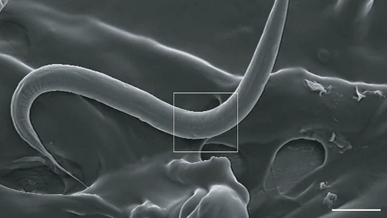 Unos investigadores de Barcelona consiguen ampliar la esperanza de vida de los gusanos C. elegans Unos investigadores de Barcelona consiguen ampliar la esperanza de vida de los gusanos C. elegans