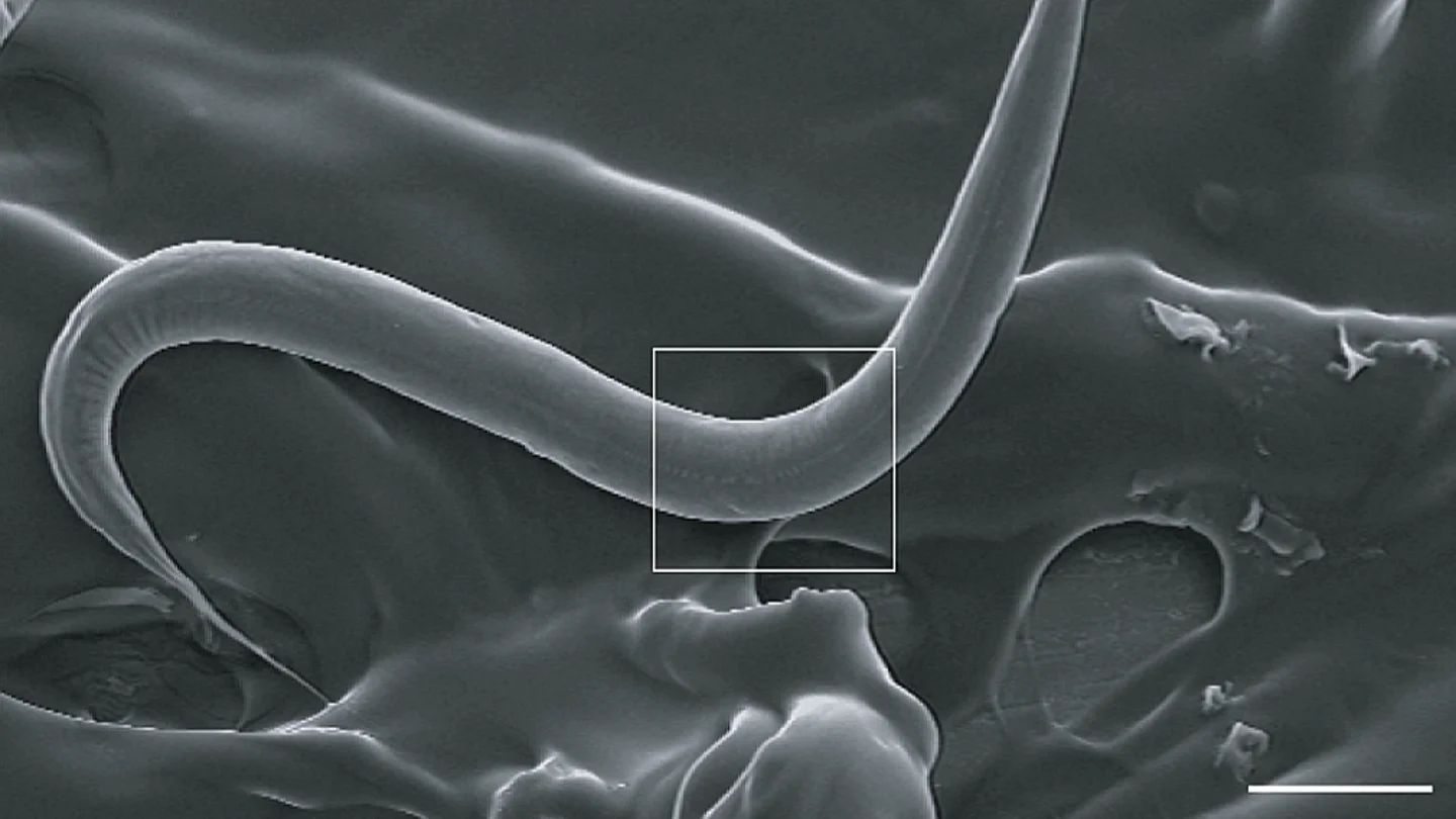 Unos investigadores de Barcelona consiguen ampliar la esperanza de vida de los gusanos C. elegans Unos investigadores de Barcelona consiguen ampliar la esperanza de vida de los gusanos C. elegans